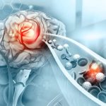 Life After an Acquired Brain Injury: Navigating Support Options